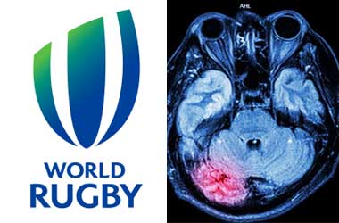 World Rugby Hit With Brain Injury Negligence Lawsuit From Ex-Players